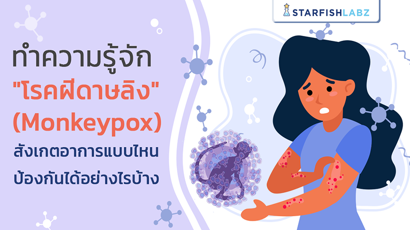 ทำความรู้จัก “โรคฝีดาษลิง” (Monkeypox) สังเกตอาการแบบไหน ป้องกันได้อย่างไร